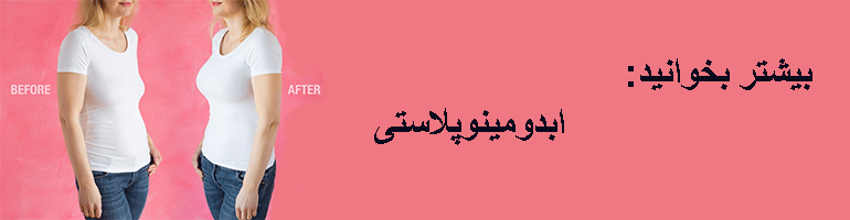 مراقبت بعد جراحی لیفت سینه