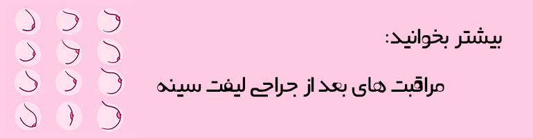 انتخاب بهترین جراح لیفت سینه 