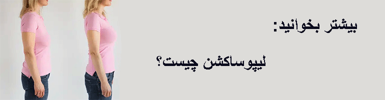 مراقبت های بعد از عمل  لیفت سینه در منزل