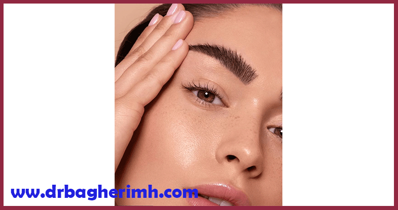 جراحی لیفت شقیقه 