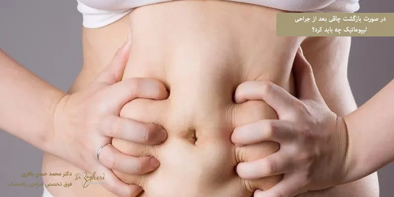 در صورت بازگشت چاقی بعد از جراحی لیپوماتیک چه باید کرد؟