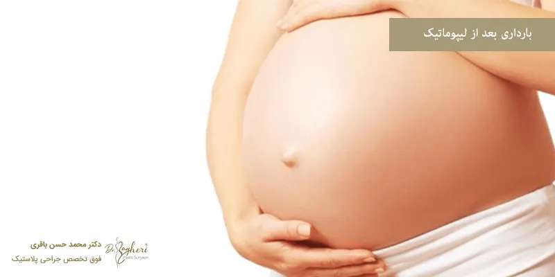 بارداری بعد از لیپوماتیک