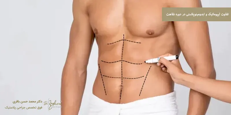 تفاوت لیپوماتیک و ابدومینوپلاستی در دوره نقاهت