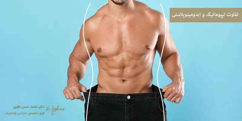 تفاوت لیپوماتیک و ابدومینوپلاستی