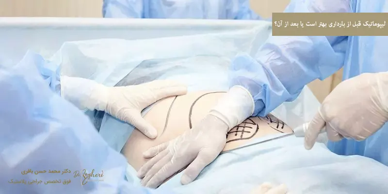 لیپوماتیک قبل از بارداری بهتر است یا بعد از آن؟