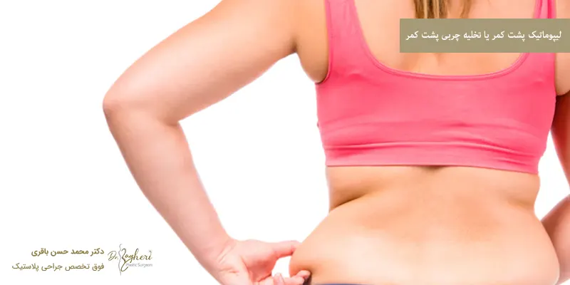 لیپوماتیک پشت کمر یا تخلیه چربی پشت کمر