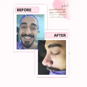 جراحی بینی نمونه کار