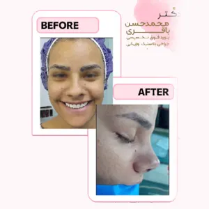 جراحی زیبایی بینی نمونه کار