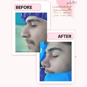 عمل بینی نمونه کار